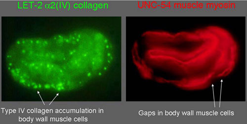 Intracellular accumulation of mutant type IV collagen Figure 4
