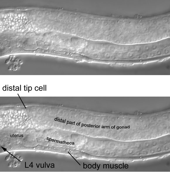 In a moderately left view, the posterior arm of an L4 gonad is prominent figure 22