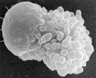 Scanning electron micrograph of spermatozoon